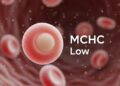 mchc blood test low